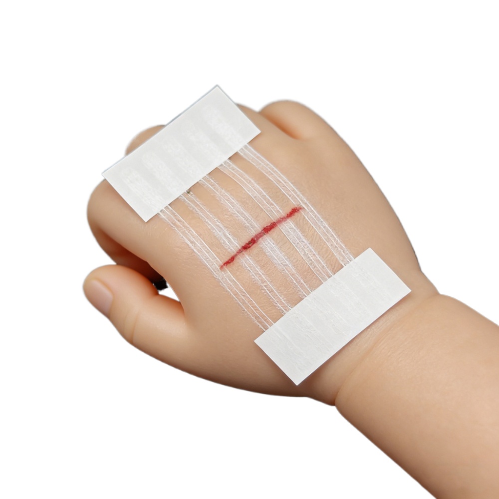 Medical Label - 5 Streifen Wundverschlussstreifen Postpartale Wundheilung Kosmetische