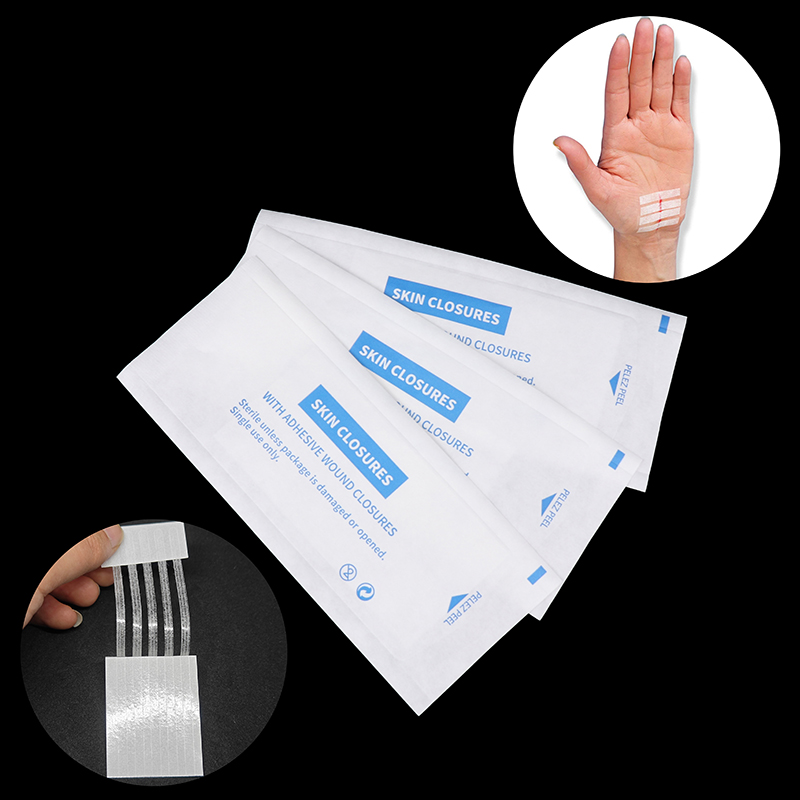 Medical Label - Sterile Streifen Narbe weg Akne Narbe