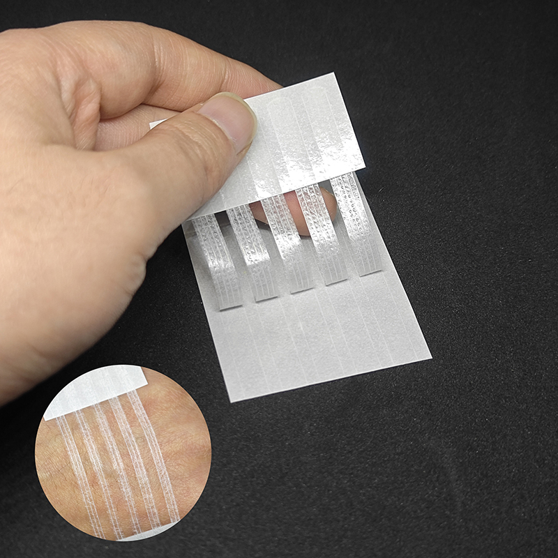 Sterile Streifen Narbe weg Akn – Medical Label Bewertung und Preis